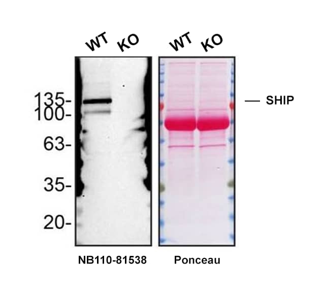 Western Blot Shows Human SHIP Specificity Using Knockout Cell Line.