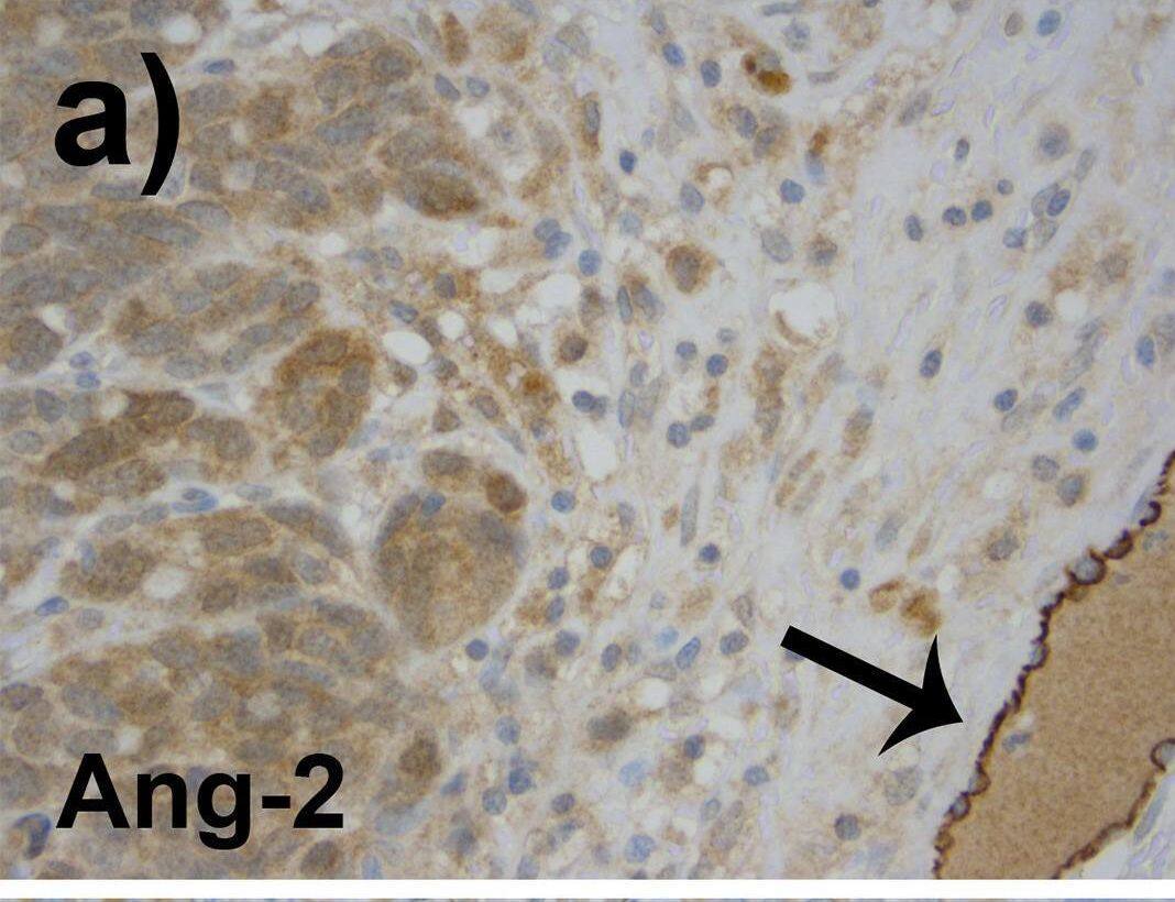 Angiopoietin-2 Antibody (MM0020-1F29) - Azide and BSA Free