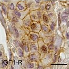 IGF-I R/IGF1R Antibody (3G5C1)