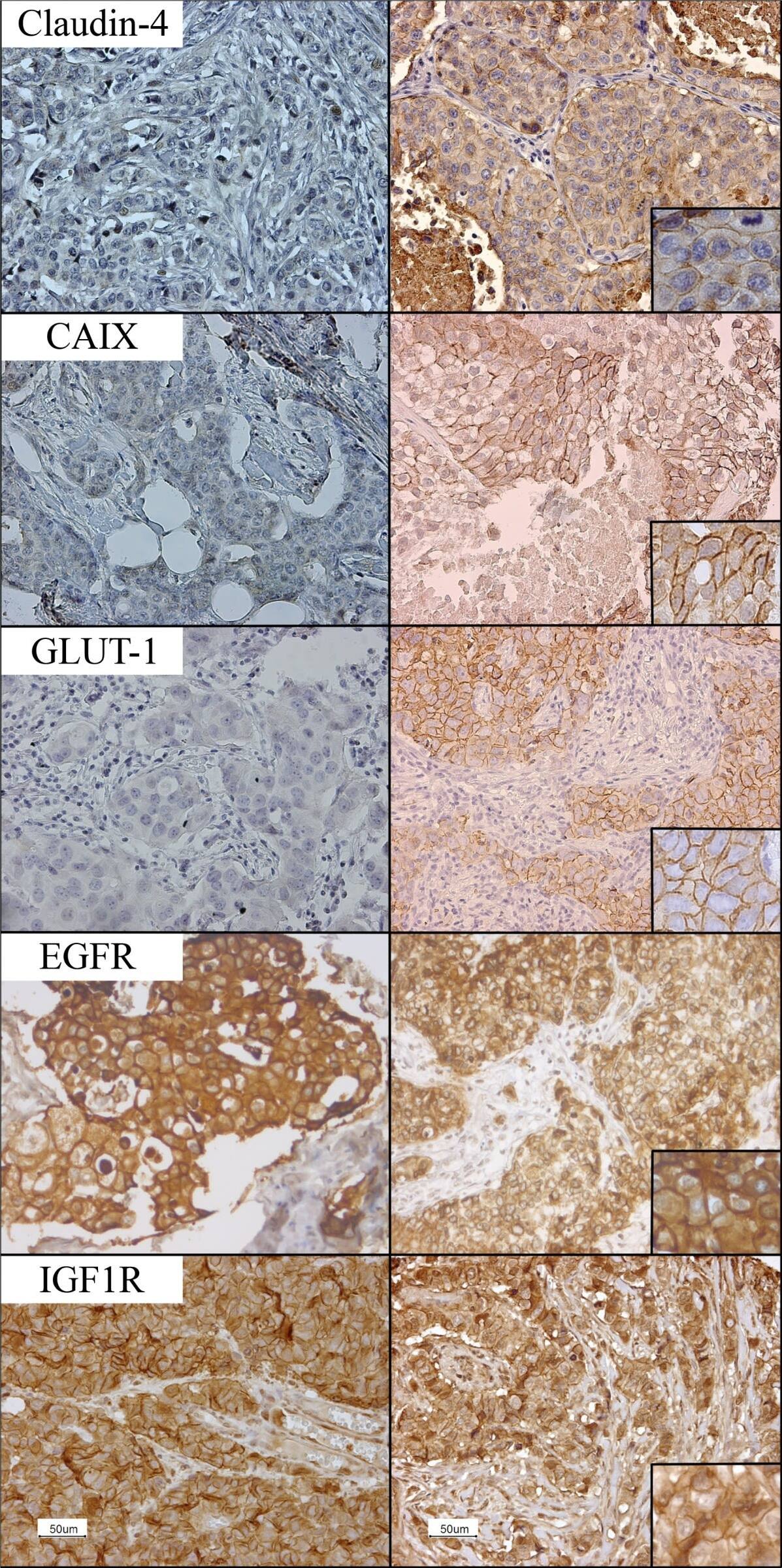 IGF-I R/IGF1R Antibody (3G5C1)