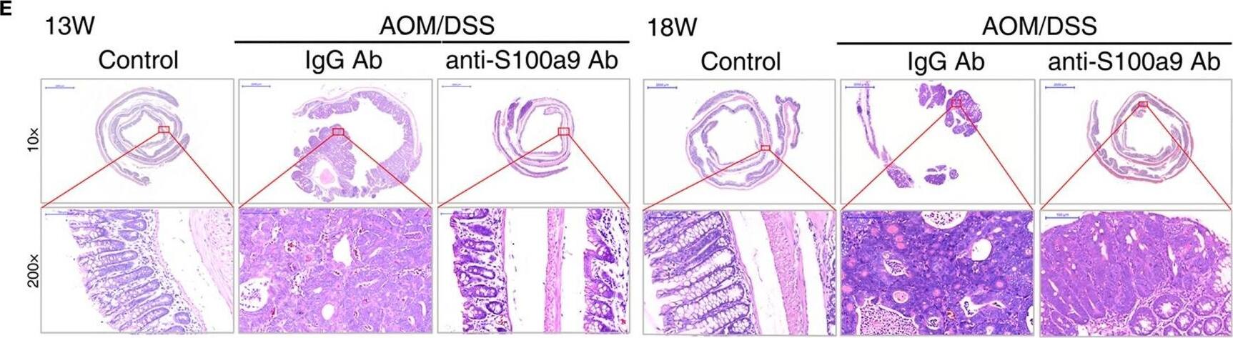 S100A9 Antibody