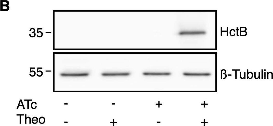 beta Tubulin Antibody (SAP.4G5)