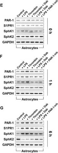 S1P1/EDG-1 Antibody