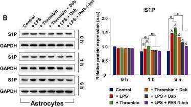 S1P1/EDG-1 Antibody