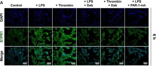 S1P1/EDG-1 Antibody
