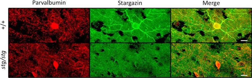 Parvalbumin Antibody - BSA Free
