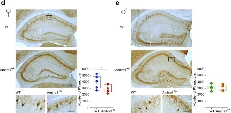 Parvalbumin Antibody - BSA Free