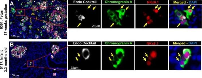 Chromogranin A Antibody - BSA Free