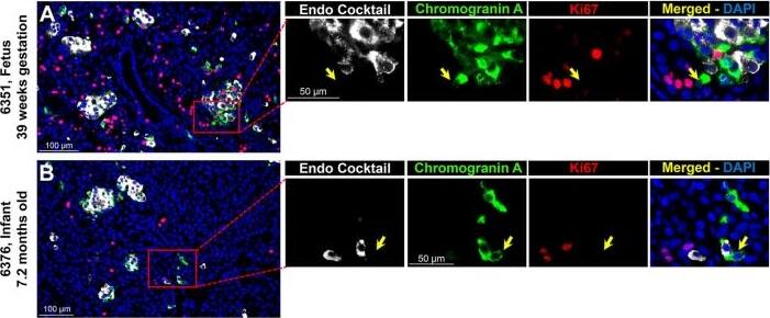 Chromogranin A Antibody - BSA Free