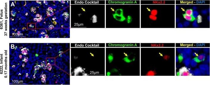 Chromogranin A Antibody - BSA Free