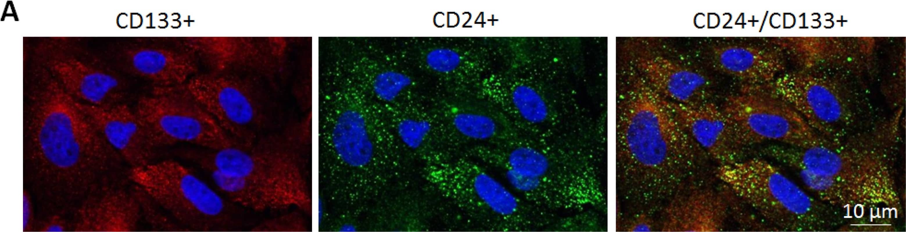 CD133 Antibody [DyLight 488]