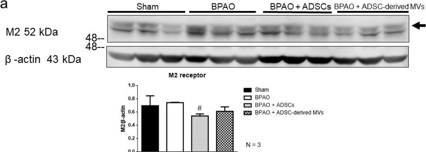 Muscarinic Acetylcholine Receptor M2/CHRM2 Antibody (31-1D1)