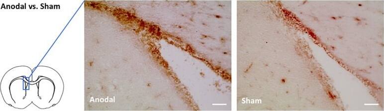 MHC Class I Antibody (OX18) - BSA Free