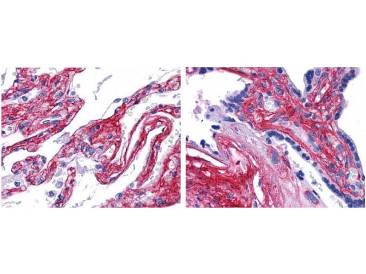 Collagen V Antibody Collagen V Antibody