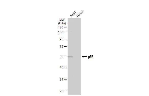 p53 Antibody (Pab1801)
