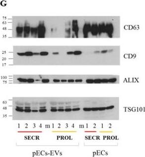 TSG101 Antibody (4A10)