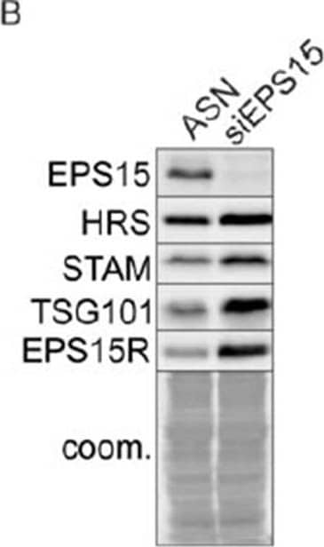 TSG101 Antibody (4A10)