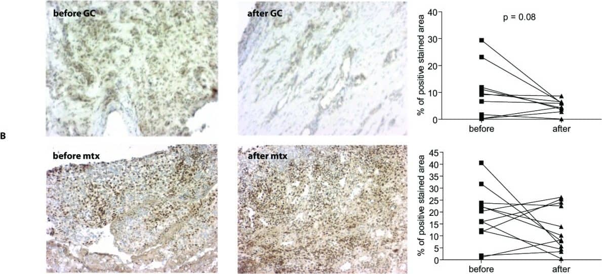15-PGDH/HPGD Antibody