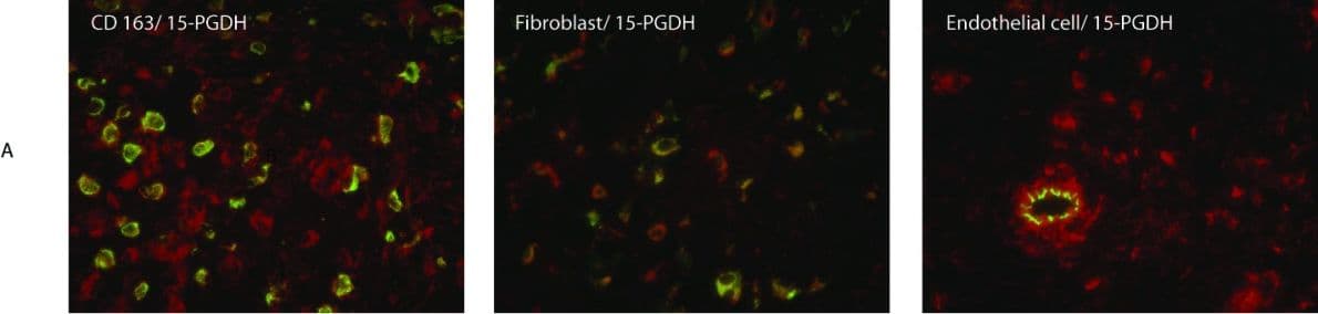 15-PGDH/HPGD Antibody