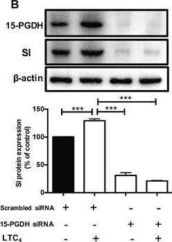 15-PGDH/HPGD Antibody
