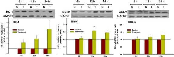 NQO-1 Antibody (A180)