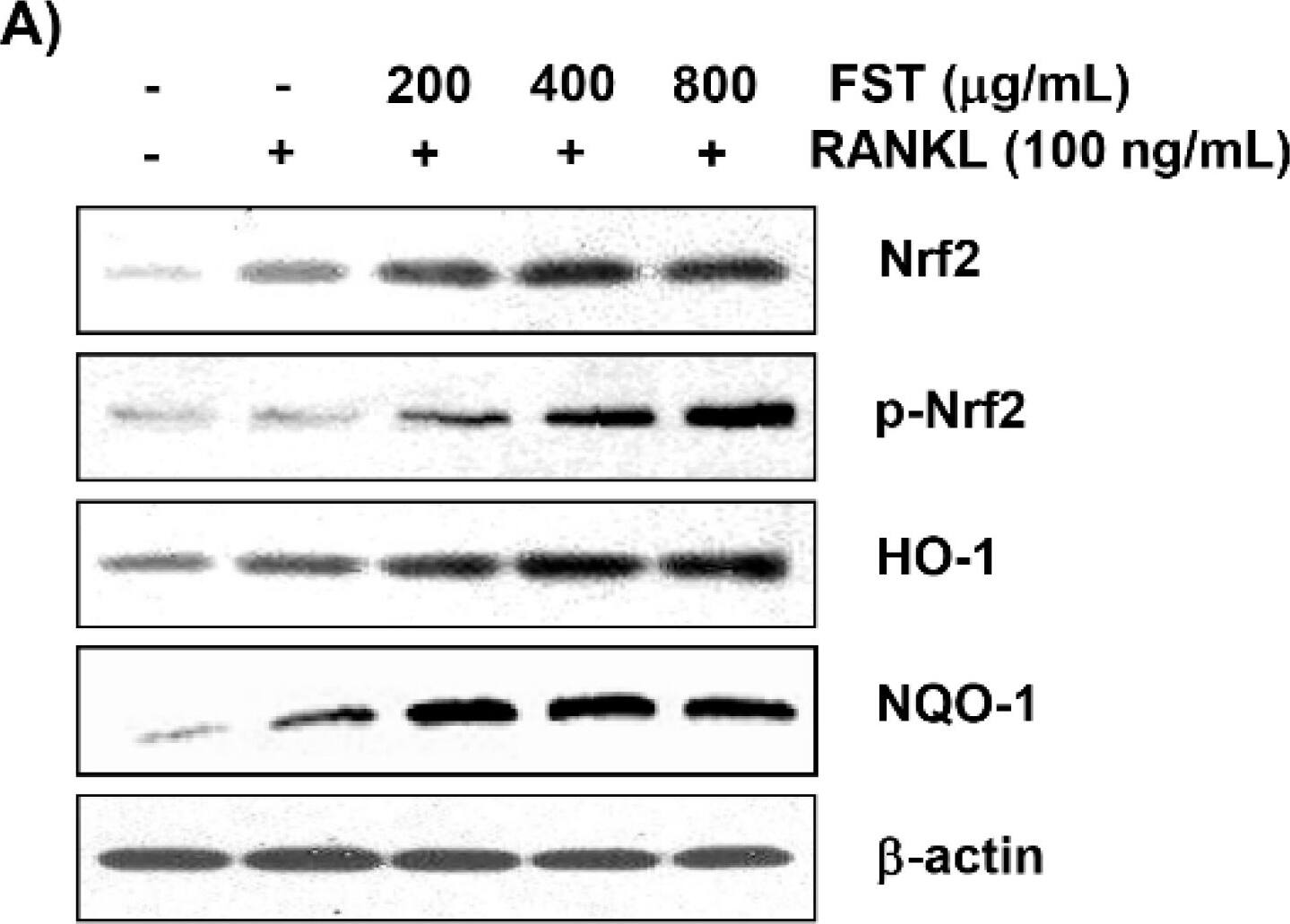 NQO-1 Antibody (A180)