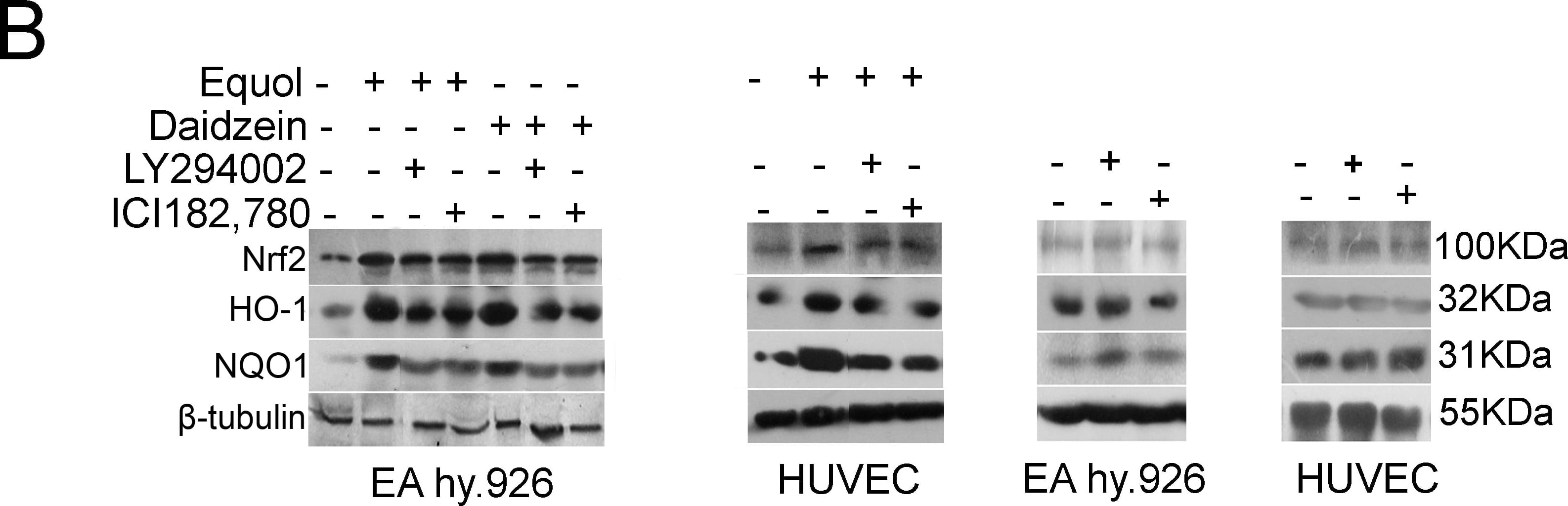 NQO-1 Antibody (A180)