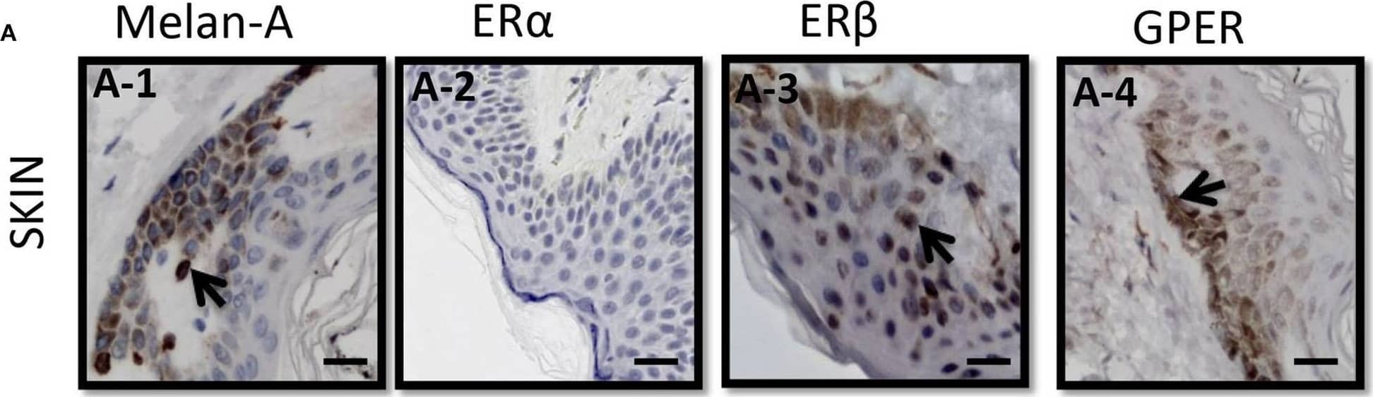 ER beta/NR3A2 Antibody (14C8) - Azide and BSA Free