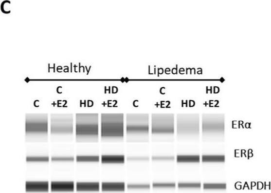 ER beta/NR3A2 Antibody (14C8) - Azide and BSA Free