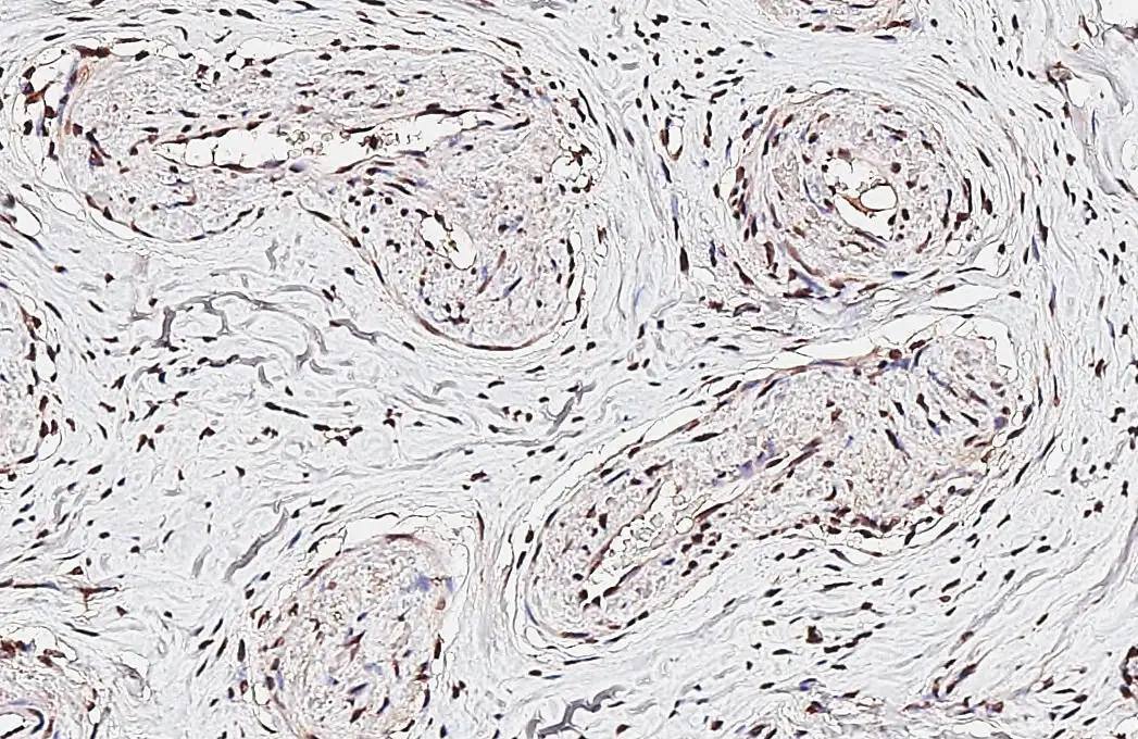 FoxO1/FKHR Antibody (7H3) - Azide and BSA Free