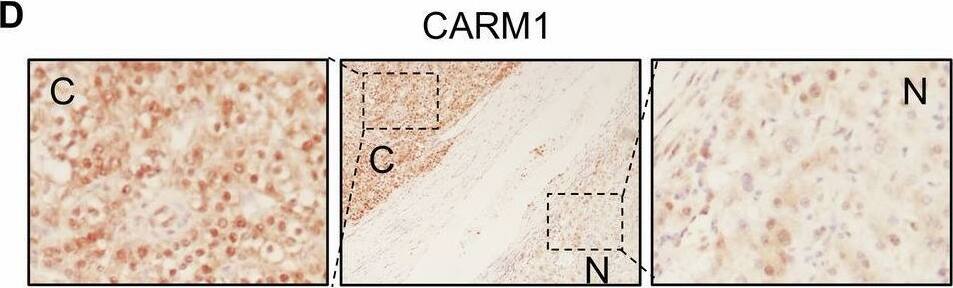 Carm1 Antibody - BSA Free