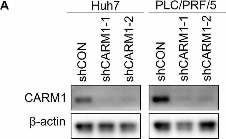 Carm1 Antibody - BSA Free