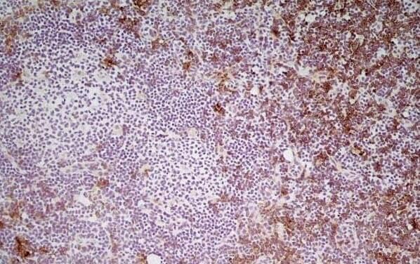 CD8 Antibody (YTS105.18) - BSA Free Immunohistochemistry-Frozen: CD8 Antibody (YTS105.18) - BSA Free [NB200-578] -