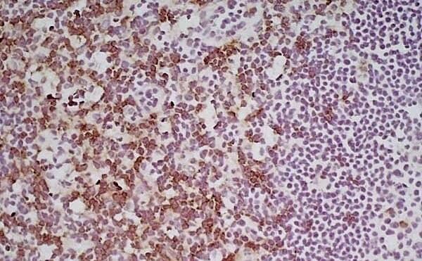 CD8 Antibody (YTS105.18) - BSA Free Immunohistochemistry-Frozen: CD8 Antibody (YTS105.18) - BSA Free [NB200-578] -