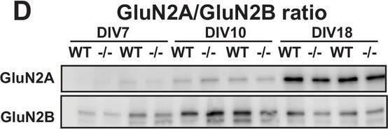 NMDAR2A Antibody
