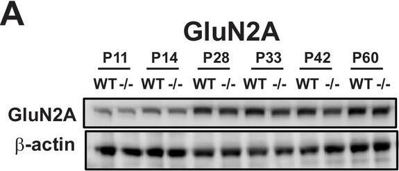 NMDAR2A Antibody
