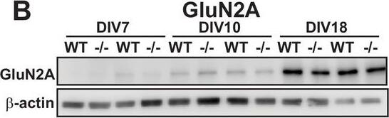 NMDAR2A Antibody
