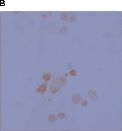 Tyrosine Hydroxylase Antibody