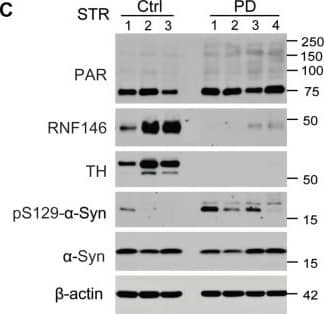 Tyrosine Hydroxylase Antibody