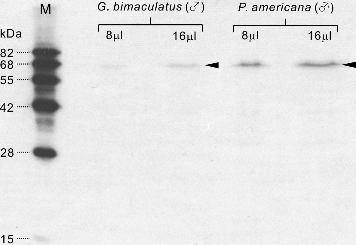 Tyrosine Hydroxylase Antibody