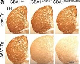Tyrosine Hydroxylase Antibody