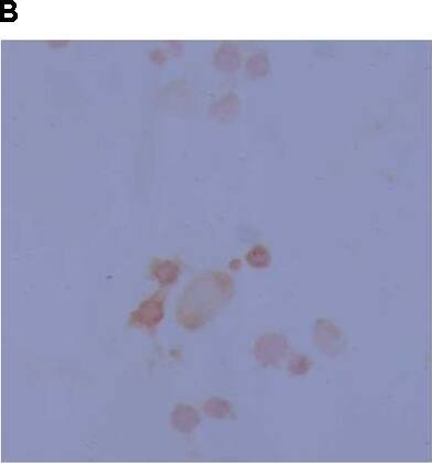 Tyrosine Hydroxylase Antibody