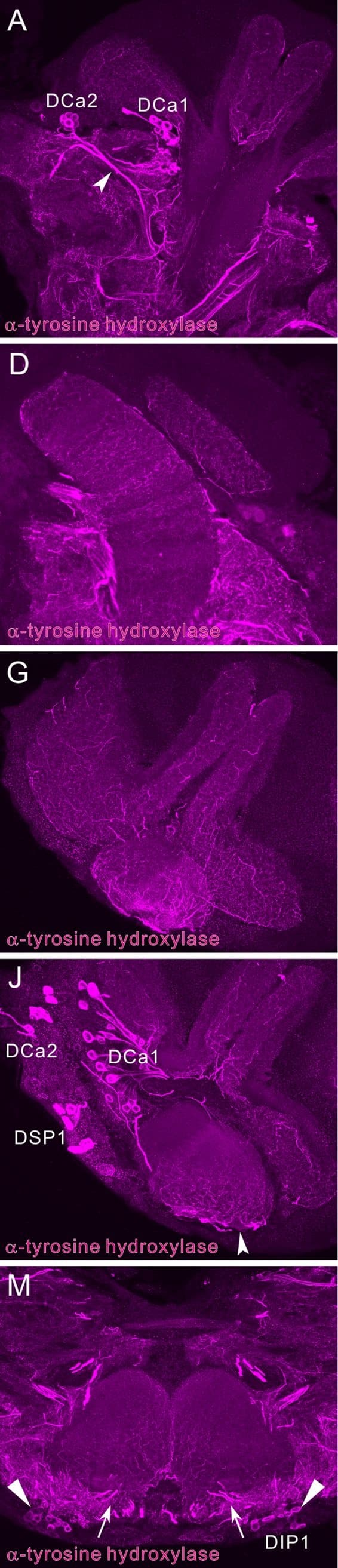 Tyrosine Hydroxylase Antibody