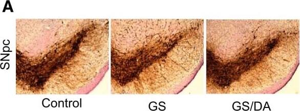 Tyrosine Hydroxylase Antibody
