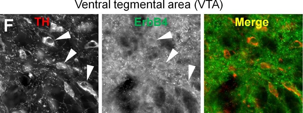 Tyrosine Hydroxylase Antibody