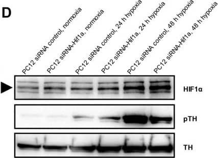 Tyrosine Hydroxylase Antibody