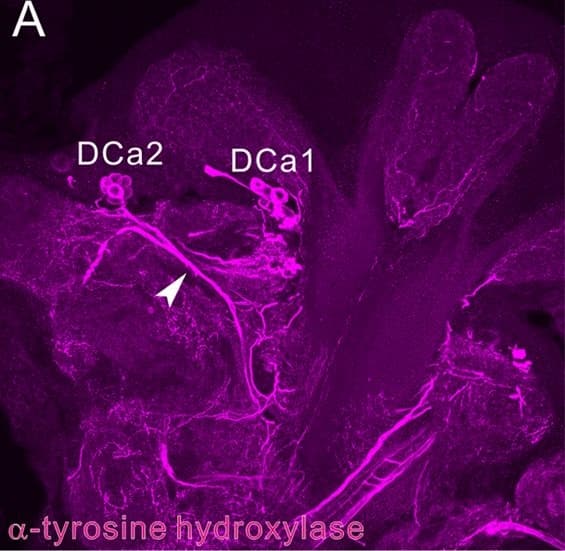 Tyrosine Hydroxylase Antibody
