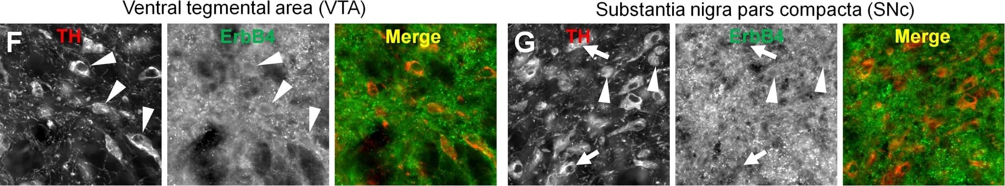Tyrosine Hydroxylase Antibody