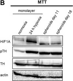Tyrosine Hydroxylase Antibody