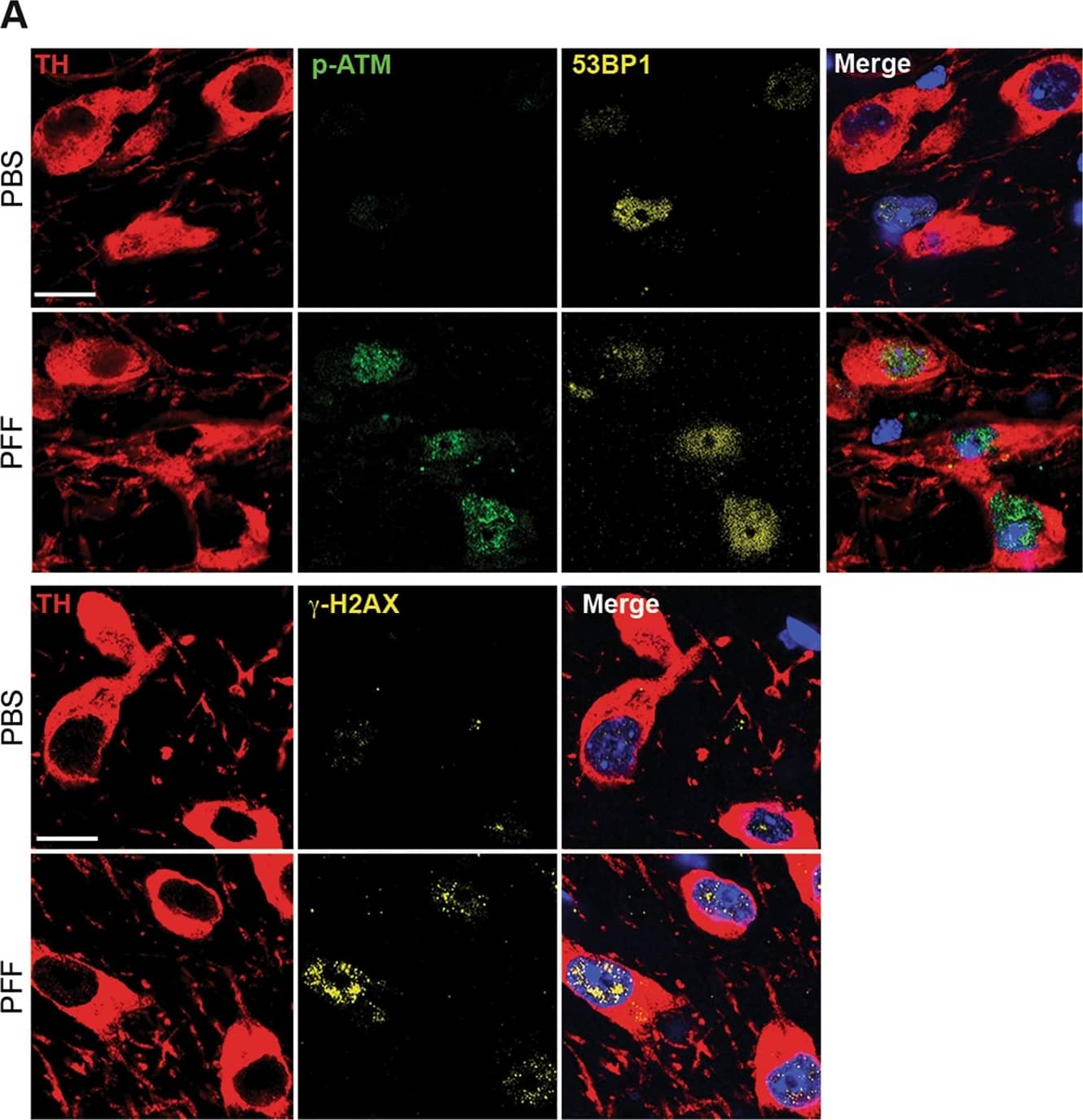 Tyrosine Hydroxylase Antibody